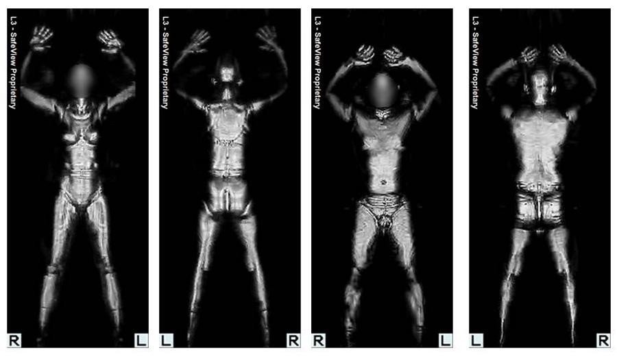The results of a body scanner, similar to the types people go through at the airport. Even the most intense X-rays one receives are only equivalent to seconds of the dose one would get while flying. Large doses would pose extreme dangers to humans, or potentially any living creature.