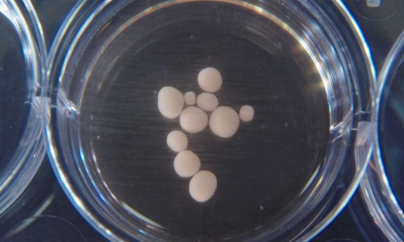 Pea-size brain organoids at 10 months old. Credit: Muotri Lab/UCTV Source: phys.org/